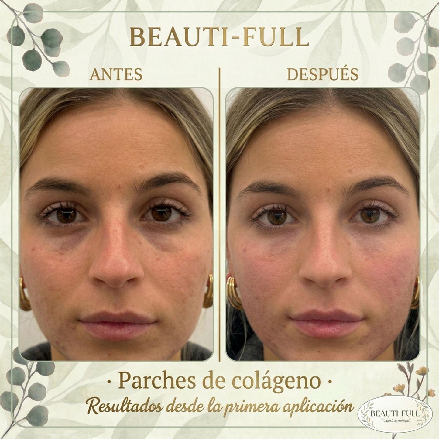 Parches de Colágeno Ojeras y Párpados x10